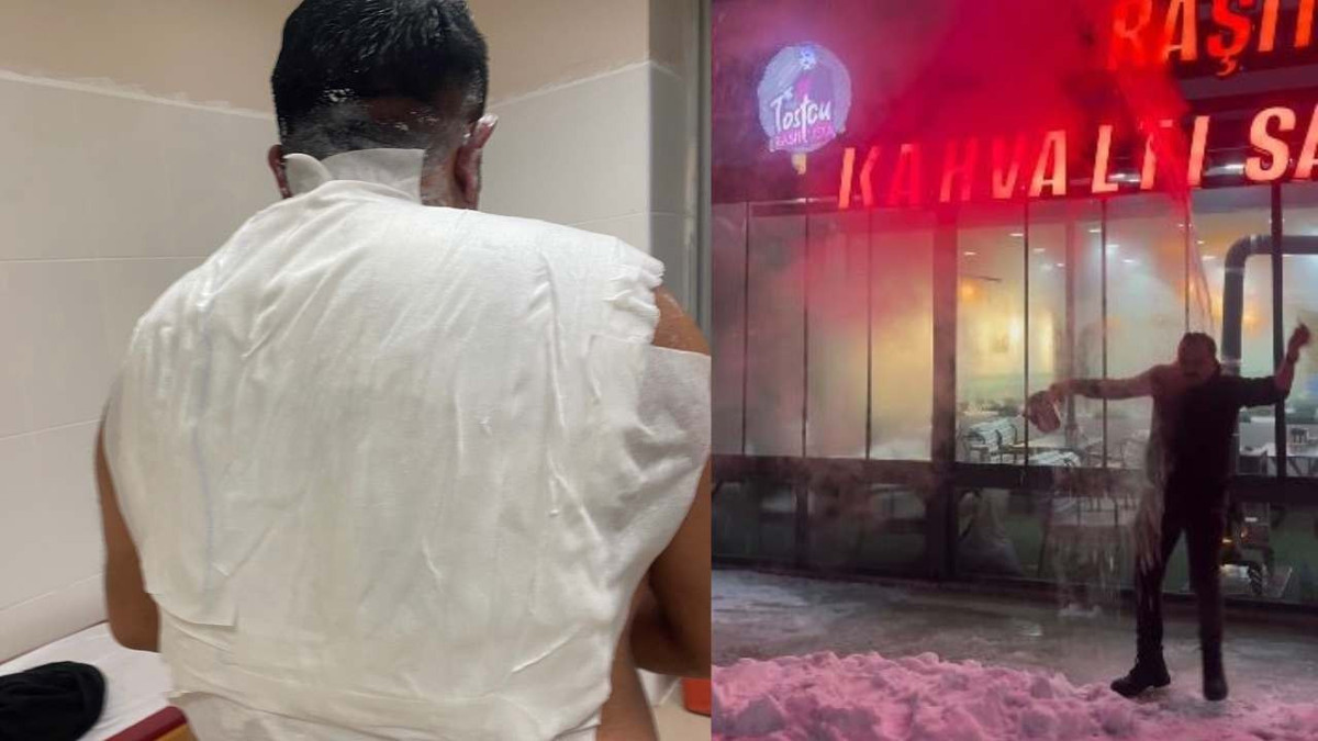 Soğuk havada şov yapmak isterken kendini yaktı