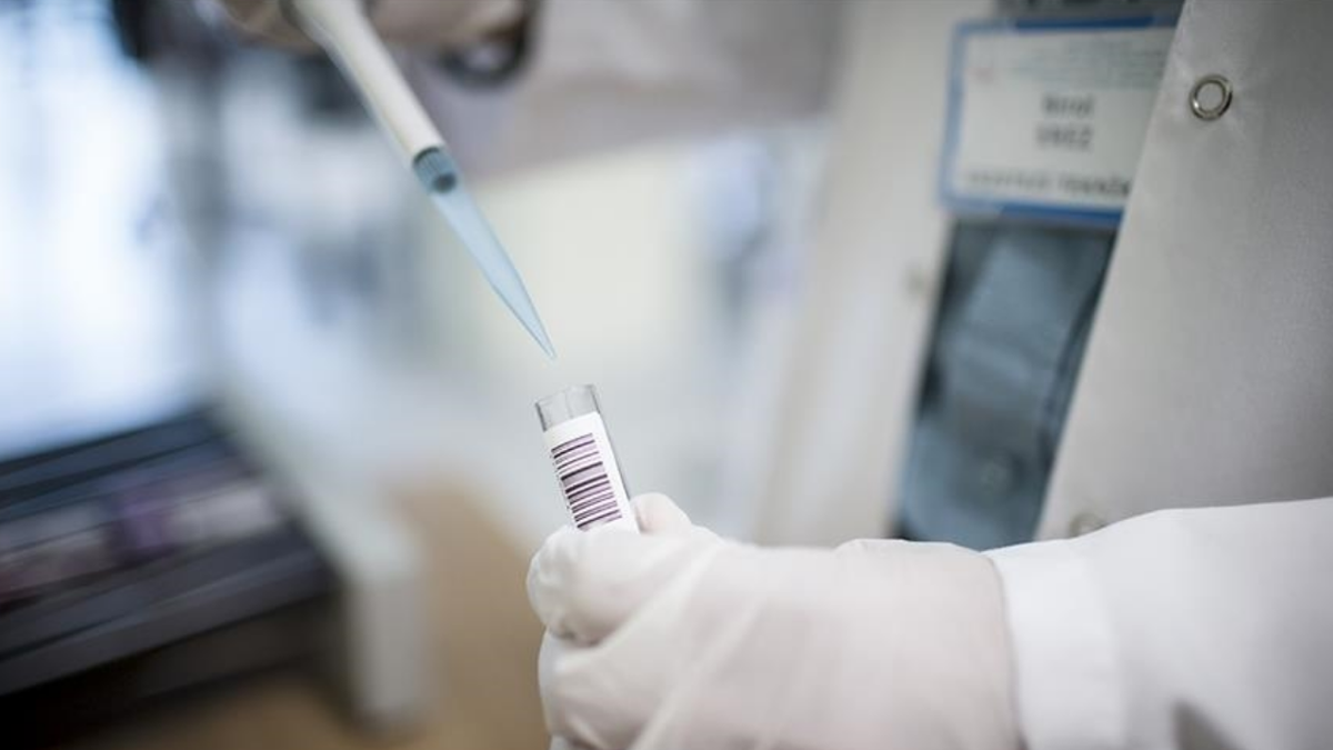 Nipah virüsü nedir, öldürür mü? Nasıl bulaşıyor? Nipah virüsü Türkiye'de var mı?