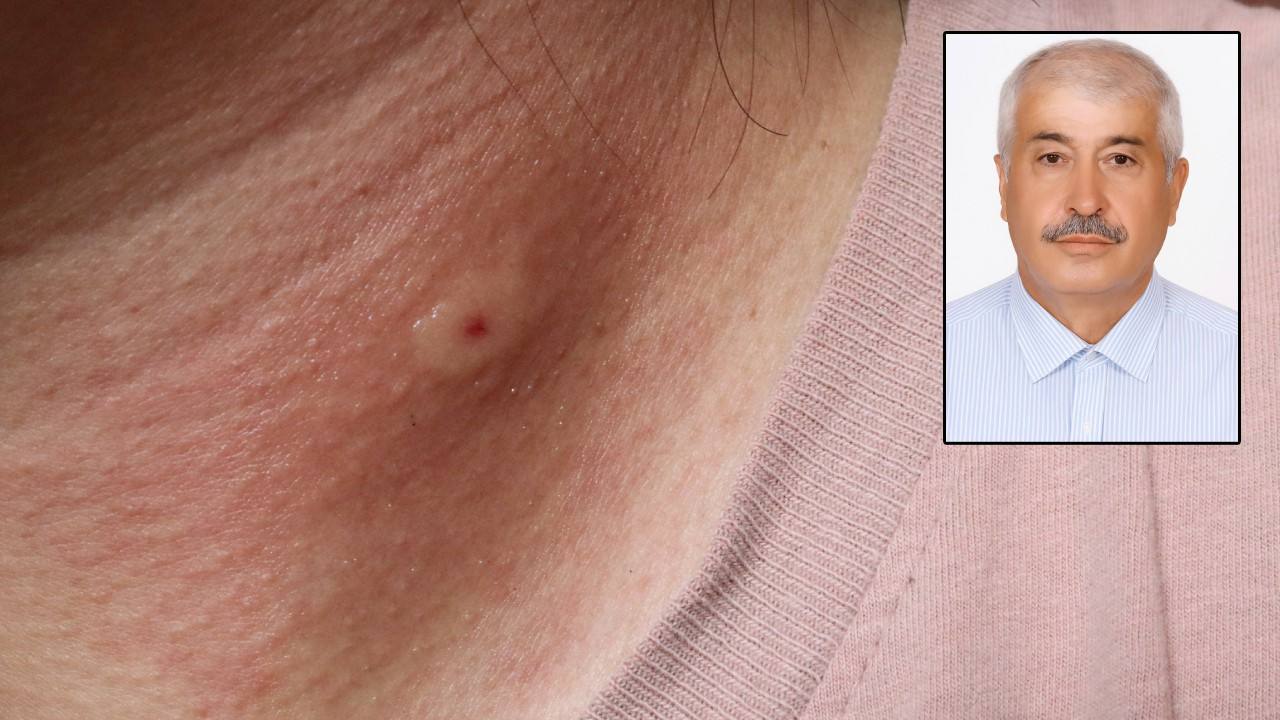 Gömleğinin içine bakınca ölüm nedeni anlaşıldı