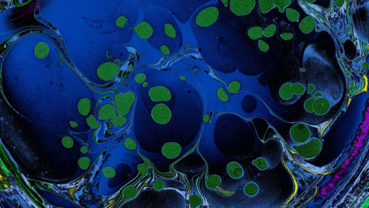 3 doktora Nobel kazandıran çalışma: Periferik bağışıklık toleransı! Kanserin tedavisi olabilir