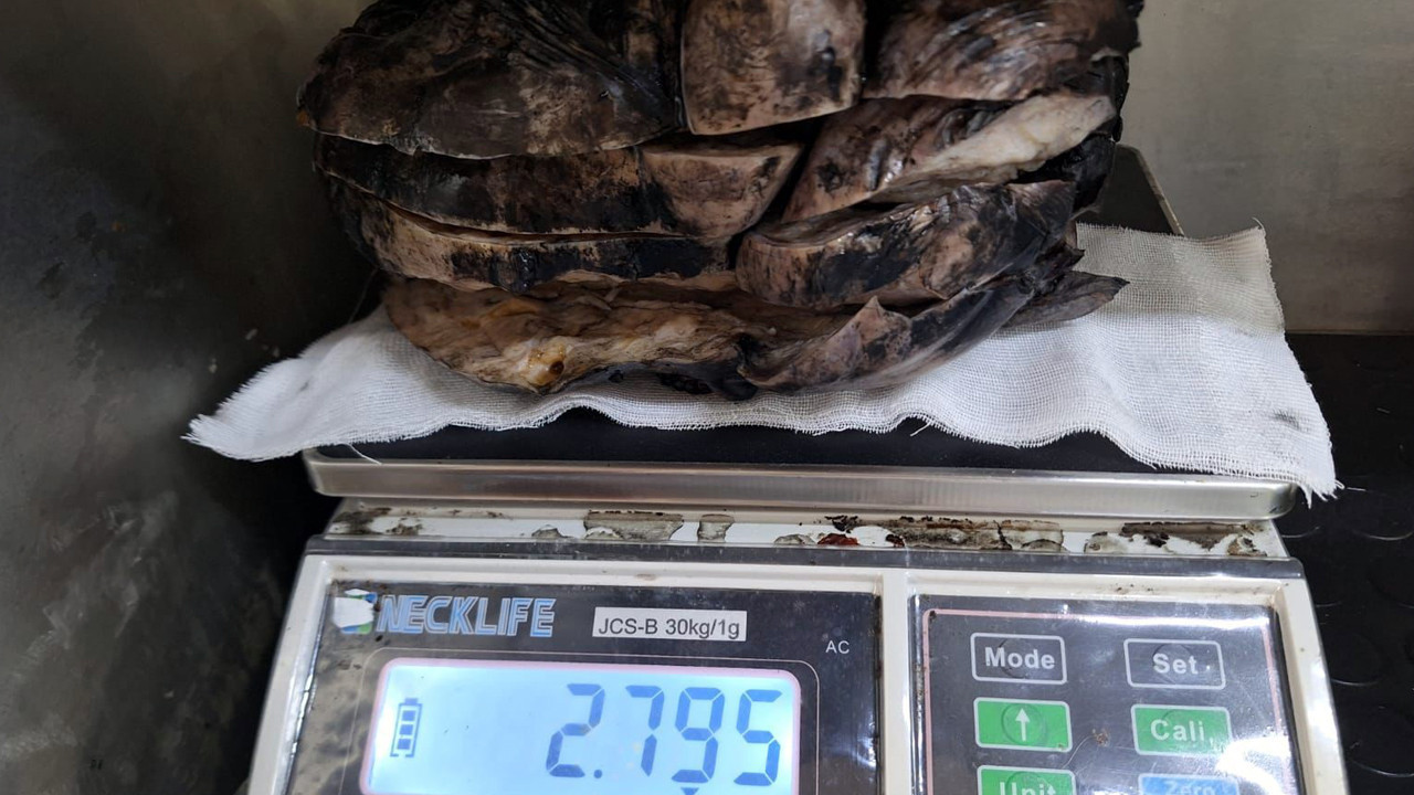 Nefes darlığı şikâyetiyle hastaneye başvurdu, tüm bunlar göğsünden çıktı!