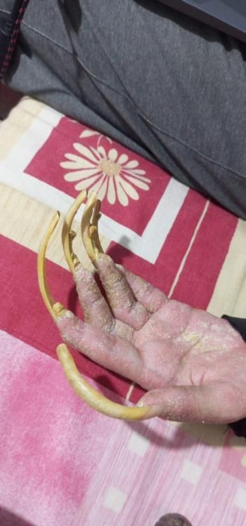 Telefon bağımlısı genç üç yıldır yıkanmıyor - Resim: 7