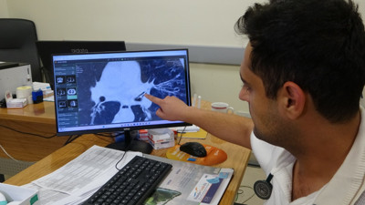 Kanserden astıma pek çok teşhis koydular: Akciğerinden çıkan şey doktorları şaşkına çevirdi