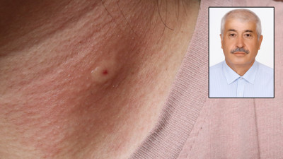 Gömleğinin içine bakınca ölüm nedeni anlaşıldı