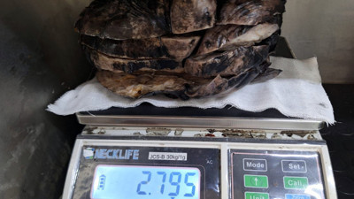 Nefes darlığı şikâyetiyle hastaneye başvurdu, tüm bunlar göğsünden çıktı!