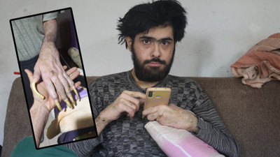 Telefon bağımlısı genç üç yıldır yıkanmıyor