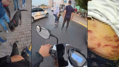 Ağızlıksız gezdirilen Rottweiler dehşet saçtı! O anlar saniye saniye kaydedildi