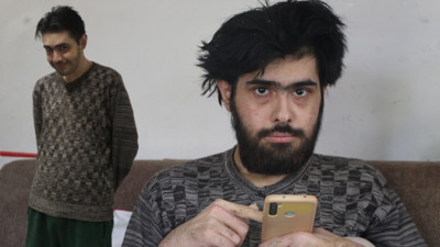 3 yıl sonra yıkanan Barış Özbay'ın hastalığı ortaya çıktı