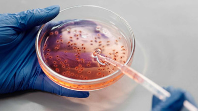 ABD'de daha önce insanlarda görülmeyen virüs can aldı!