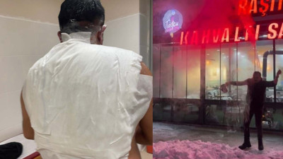 Soğuk havada şov yapmak isterken kendini yaktı