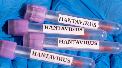 Sağlık Bakanlığı'ndan Hantavirüs açıklaması