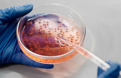 ABD'de daha önce insanlarda görülmeyen virüs can aldı!