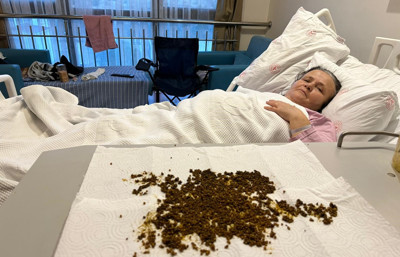 Karın ağrısı şikâyetiyle başvurdu! Dehşet verici bir rekora imza attı