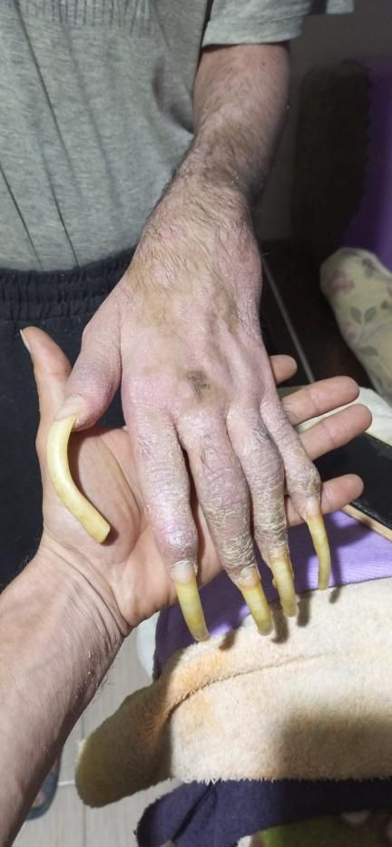 Telefon bağımlısı genç üç yıldır yıkanmıyor - Resim: 6