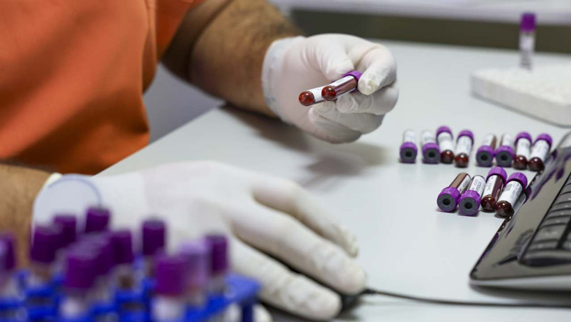 6 milyonda bir rastlanıyor: Anne ve bebeğini İspanya'dan getirilen "altın kan" kurtardı! - Resim : 1