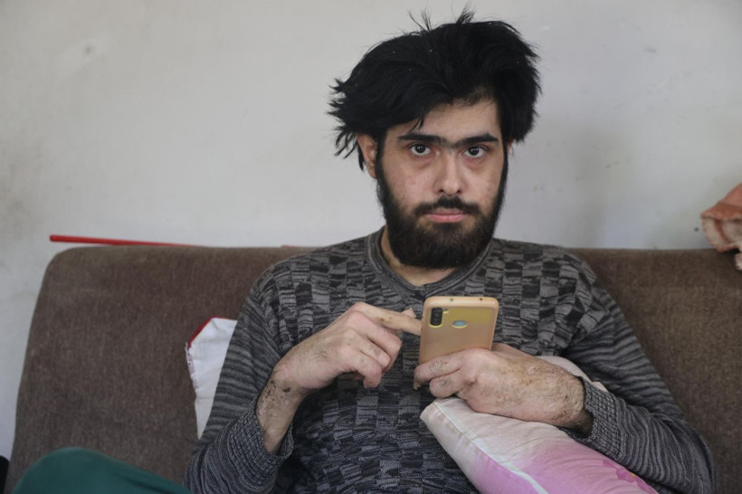 Telefon bağımlısı genç üç yıldır yıkanmıyor - Resim: 2