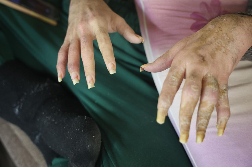 Telefon bağımlısı genç üç yıldır yıkanmıyor - Resim: 5