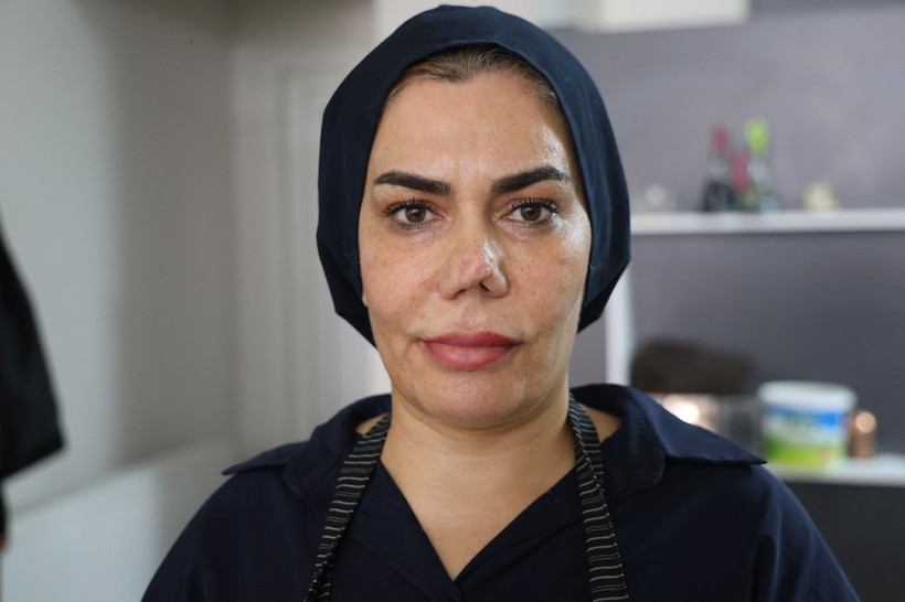 Her ameliyat öncesi tam altın verdi, son halini görünce aynalara küstü - Resim: 1