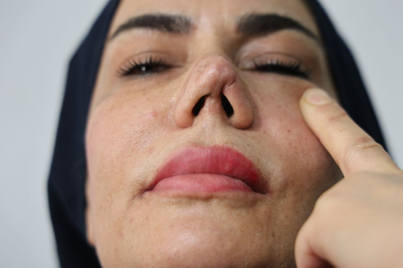 Her ameliyat öncesi tam altın verdi, son halini görünce aynalara küstü - Resim: 9